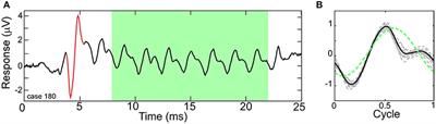 A Model-Based Approach for Separating the Cochlear Microphonic from the Auditory Nerve Neurophonic in the Ongoing Response Using Electrocochleography